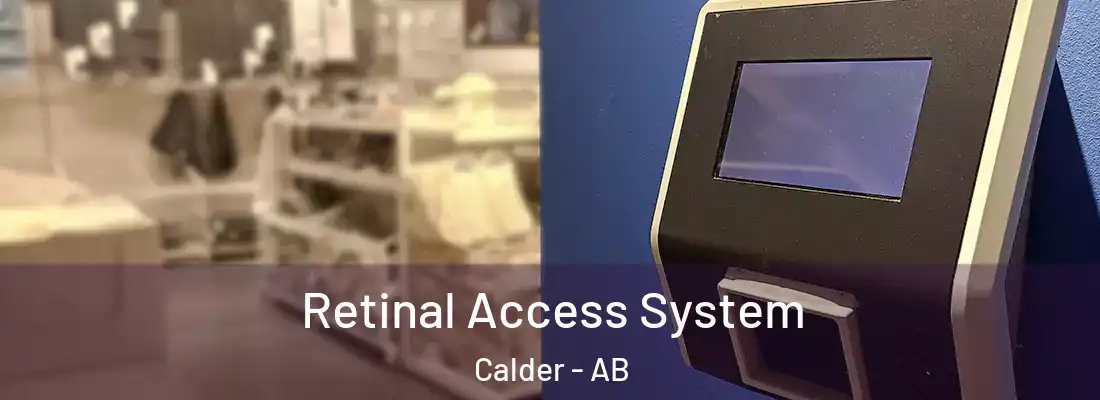  Retinal Access System Calder - AB