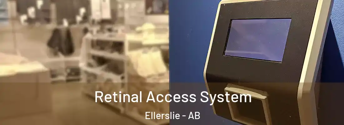  Retinal Access System Ellerslie - AB